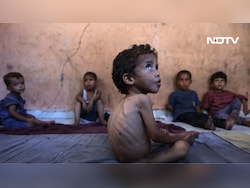 Opinion | How Many Dead Babies Does A War Need?