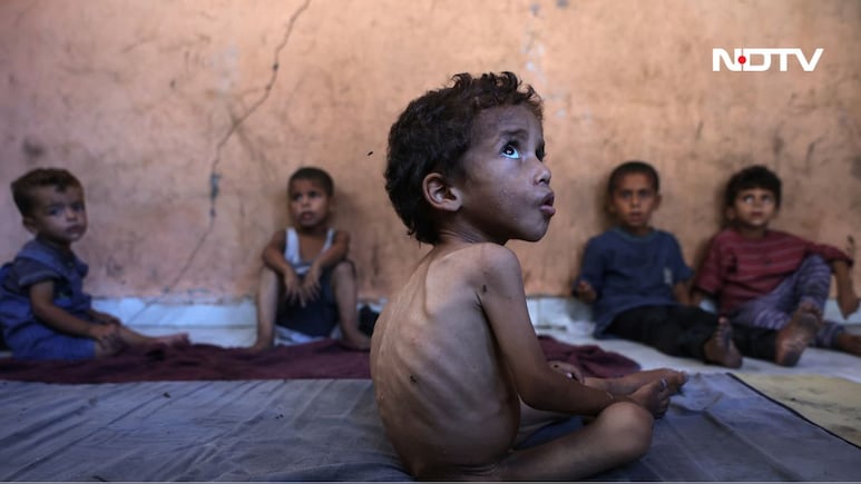 Opinion | How Many Dead Babies Does A War Need?