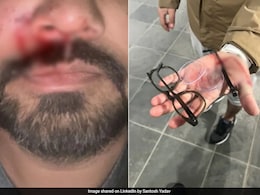 आयरलैंड में एक और भारतीय मूल के व्यक्ति पर "नस्लवादी" हमला, गाल की हड्डी तक तोड़ी आयरलैंड में एक और भारतीय मूल के व्यक्ति पर "नस्लवादी" हमला, गाल की हड्डी तक तोड़ी