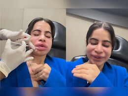 Urfi Javed: सुजलेले ओठ, लालबुंद तोंड.. उर्फी जावेदच्या चेहऱ्याची झाली दुर्दशा, पाहा VIDEO