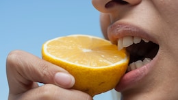 10 Best And Worst Foods For Your Teeth: What To Eat And What To Avoid