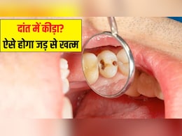 दांत में लग गया है कीड़ा? डेंटिस्ट ने बताया दांत को खोखला होने से रोकने का सबसे आसान तरीका, एक काम करने से मोती जैसे सफेद रहेंगे Teeth दांत में लग गया है कीड़ा? डेंटिस्ट ने बताया दांत को खोखला होने से रोकने का सबसे आसान तरीका, एक काम करने से मोती जैसे सफेद रहेंगे Teeth