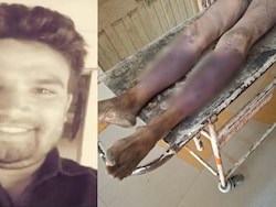 40 Fractures, Blunt Trauma: Indore Man Dies After Mob Assault Over Theft