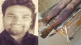 40 Fractures, Blunt Trauma: Indore Man Dies After Mob Assault Over Theft