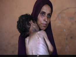 "Body Sacrifices Own Tissue": Gaza Doctor On The Impact Of Starvation "Body Sacrifices Own Tissue": Gaza Doctor On The Impact Of Starvation