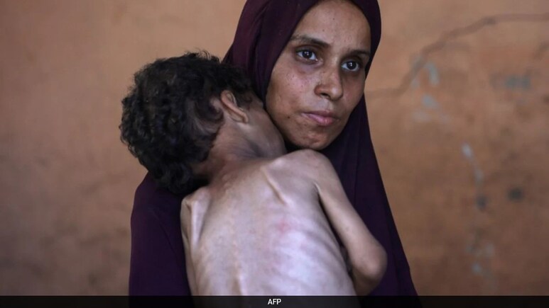 'Horrific': Court On Malnutrition Deaths Of Kids In Maharashtra's Tribal Region