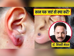 कान छिदवाने के बाद पक जाएं तो क्या करें? डॉक्टर ने बताया कौनसी चीज लगाने से जल्दी भर जाएगा घाव कान छिदवाने के बाद पक जाएं तो क्या करें? डॉक्टर ने बताया कौनसी चीज लगाने से जल्दी भर जाएगा घाव