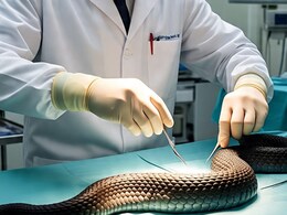 Rajasthan: अजमेर में डॉक्टर्स ने की 8 फीट लंबे ब्लैक कोबरा की सर्जरी, लगे 20 टांके