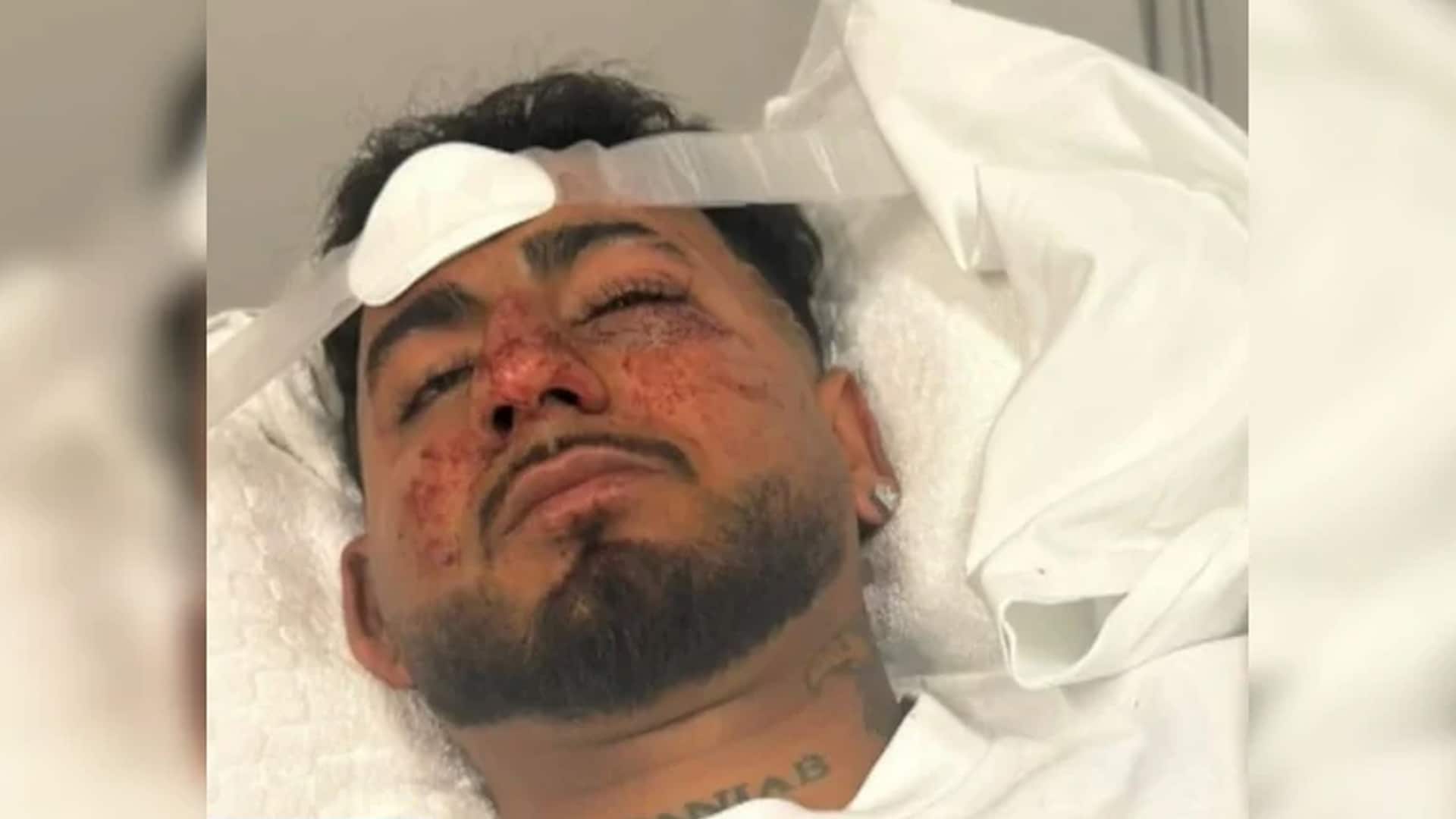 Video : "F*** Off, Indian": Man Brutally Assaulted, Racially Abused In Australia