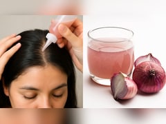 Onion Juice for Hair Growth: प्याज के रस से लंबे, काले और घने होंगे बाल, बदबू की वजह से नहीं करते इस्तेमाल, तो जान लें सही तरीका