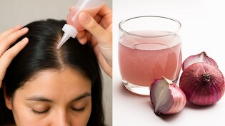 Onion Juice for Hair Growth: प्याज के रस से लंबे, काले और घने होंगे बाल, बदबू की वजह से नहीं करते इस्तेमाल, तो जान लें सही तरीका