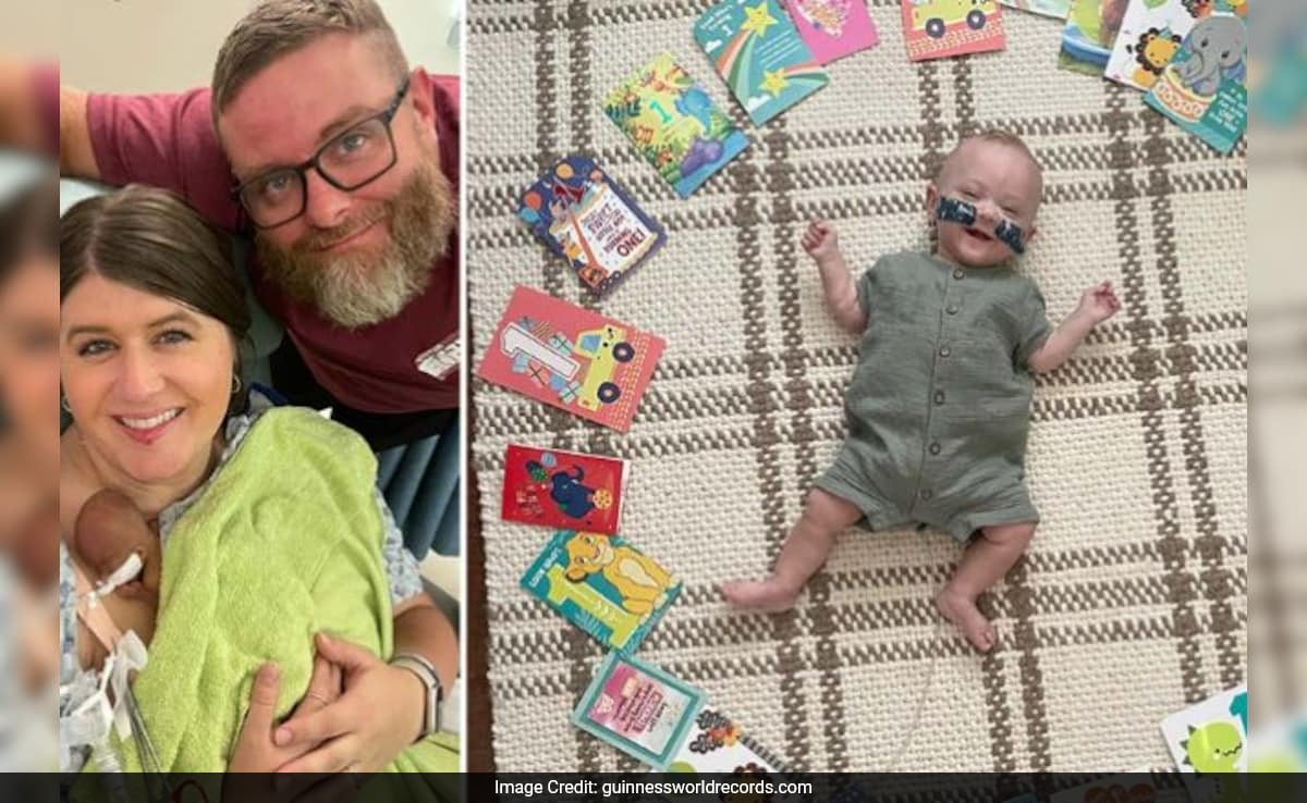 бебе родено само на 21 седмици гестация миналия юли в