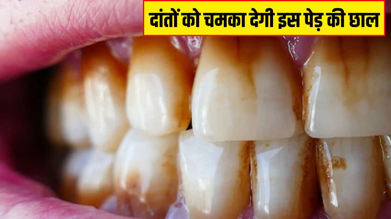 आचार्य बालकृष्ण ने बताया दांतों की हर परेशानी को दूर कर देगी इस पेड़ की छाल, सफेद मोती जैसे चमकने लगेंगे Teeth