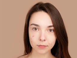 Can Popping A Pimple In 'The Triangle Of Death' On Your Face Actually Kill You? Can Popping A Pimple In 'The Triangle Of Death' On Your Face Actually Kill You?
