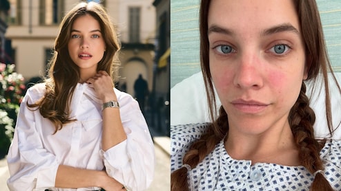 Model And Actor Barbara Palvin Opens Up About Endometriosis Diagnosis: Know What It Means