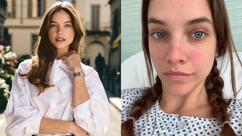 Model And Actor Barbara Palvin Opens Up About Endometriosis Diagnosis: Know What It Means Model And Actor Barbara Palvin Opens Up About Endometriosis Diagnosis: Know What It Means