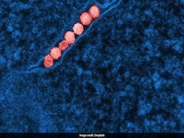 All You Need To Know About West Nile Virus That's Spreading Across Europe All You Need To Know About West Nile Virus That's Spreading Across Europe