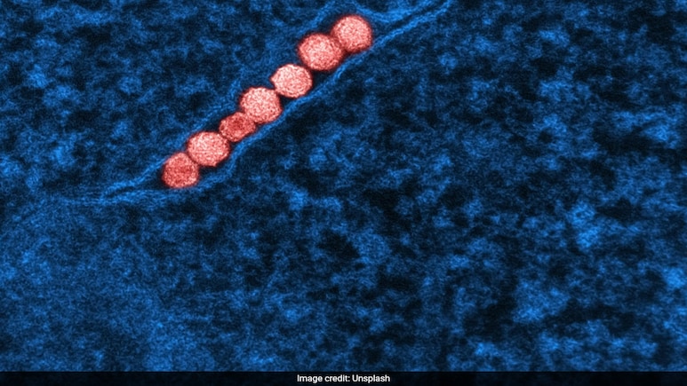 All You Need To Know About West Nile Virus That's Spreading Across Europe All You Need To Know About West Nile Virus That's Spreading Across Europe