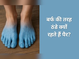 शरीर में किस कमी से सर्दियों में हाथ-पैर रहते हैं ज्यादा ठंडे? कैसे दूर होगी ये समस्या