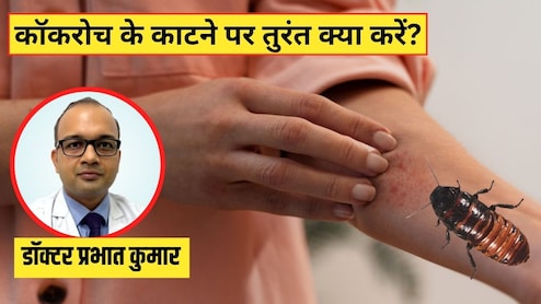 कॉकरोच काट ले तो क्या होता है? डॉक्टर ने बताया इन लक्षणों को न करें नजरअंदाज, जानें सबसे पहले क्या करें
