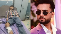 Man Who Shot At Elvish Yadav's Gurugram House Arrested In Police Encounter