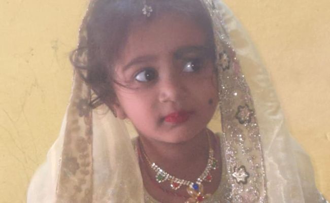 Karnataka Girl, 4, Dies Of Rabies Four Months After Stray Dog Bite