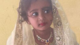 Karnataka Girl, 4, Dies Of Rabies Four Months After Stray Dog Bite