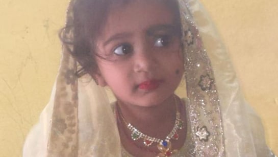 Karnataka Girl, 4, Dies Of Rabies Four Months After Stray Dog Bite