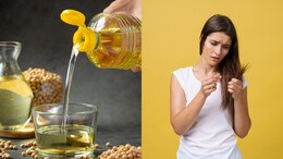 Want To Stop Hair Fall? Jawed Habib Shares A Simple Home Remedy