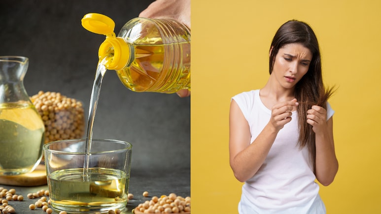 Want To Stop Hair Fall? Jawed Habib Shares A Simple Home Remedy Want To Stop Hair Fall? Jawed Habib Shares A Simple Home Remedy
