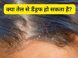 क्या तेल से डैंड्रफ हो सकता है? आयुर्वेदिक एक्सपर्ट ने बताया कैसे बालों पर कौनसा ऑयल लगाना चाहिए क्या तेल से डैंड्रफ हो सकता है? आयुर्वेदिक एक्सपर्ट ने बताया कैसे बालों पर कौनसा ऑयल लगाना चाहिए