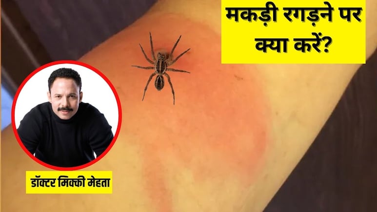 मकड़ी शरीर पर रगड़ गई है? डॉक्‍टर म‍िकी मेहता ने कहा तुरंत कर लें यह नहीं होगी जलन