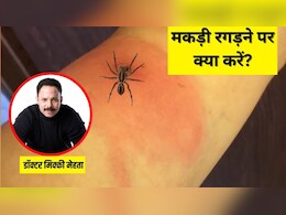 मकड़ी शरीर पर रगड़ गई है? डॉक्टर मिकी मेहता ने कहा तुरंत कर लें यह नहीं होगी जलन मकड़ी शरीर पर रगड़ गई है? डॉक्टर मिकी मेहता ने कहा तुरंत कर लें यह नहीं होगी जलन