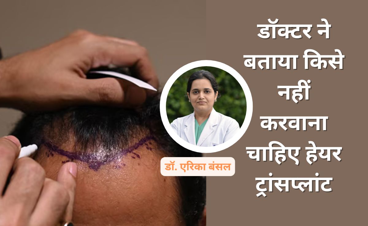 कब नहीं कराना चाहिए हेयर ट्रांसप्लांट? Dr. Arika Bansal ने बताए कौनसे रेड फ्लैग्स पता होने जरूरी हैं