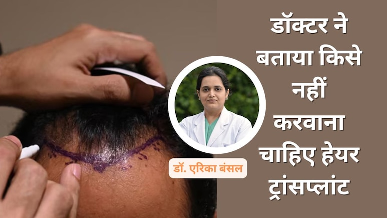 कब नहीं कराना चाहिए हेयर ट्रांसप्लांट? Dr. Arika Bansal ने बताए कौनसे रेड फ्लैग्स पता होने जरूरी हैं कब नहीं कराना चाहिए हेयर ट्रांसप्लांट? Dr. Arika Bansal ने बताए कौनसे रेड फ्लैग्स पता होने जरूरी हैं