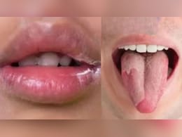 कौन से विटामिन की कमी से किनारे से काले पड़ जाते हैं होंठ? AIIMS में काम कर चुकी डॉक्टर ने बताया क्या खाने से दूर होगी दिक्कत कौन से विटामिन की कमी से किनारे से काले पड़ जाते हैं होंठ? AIIMS में काम कर चुकी डॉक्टर ने बताया क्या खाने से दूर होगी दिक्कत