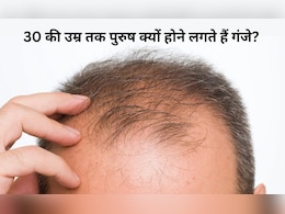 30 की उम्र से पहले ही क्यों झड़ने लगते हैं पुरुषों के बाल? डॉक्टर ने बताया कौन सी गलतियां बनती हैं वजह 30 की उम्र से पहले ही क्यों झड़ने लगते हैं पुरुषों के बाल? डॉक्टर ने बताया कौन सी गलतियां बनती हैं वजह