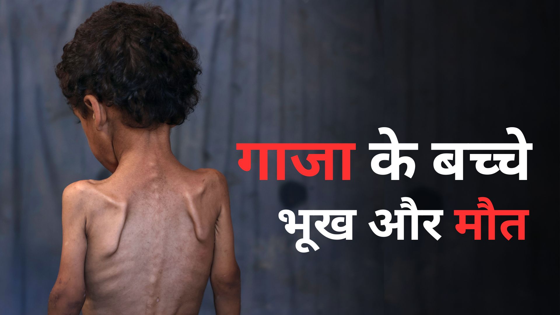 गाजा में भूख से मरते बच्चे! नवजातों की आंतें दूध मांगती हैं, लेकिन चना-चारा खिलाने की मजबूरी