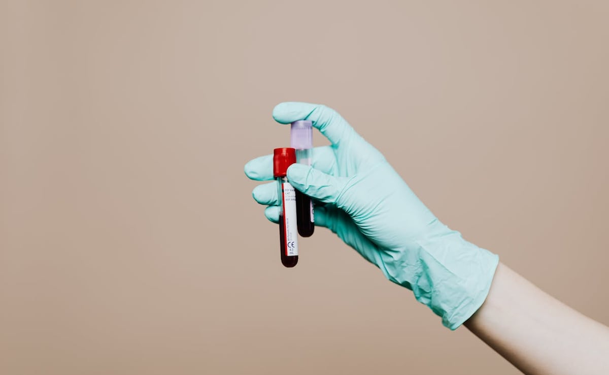 Health Decoder: How To Read Your Complete Blood Count Report
