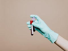 Health Decoder: How To Read Your Complete Blood Count Report