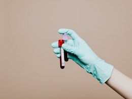Health Decoder: How To Read Your Complete Blood Count Report Health Decoder: How To Read Your Complete Blood Count Report