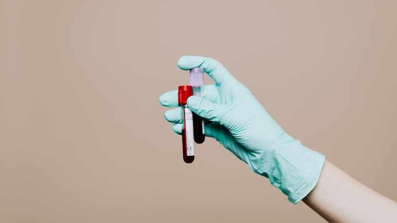 Health Decoder: How To Read Your Complete Blood Count Report Health Decoder: How To Read Your Complete Blood Count Report