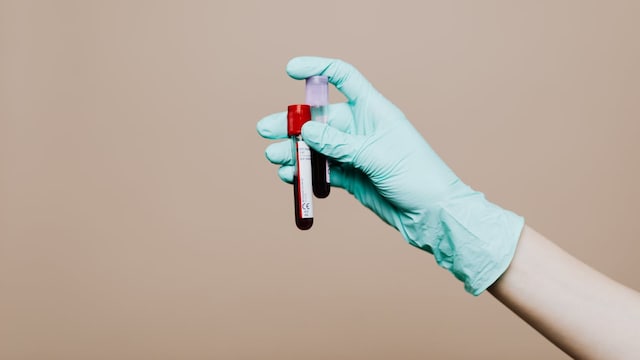 Health Decoder: How To Read Your Complete Blood Count Report