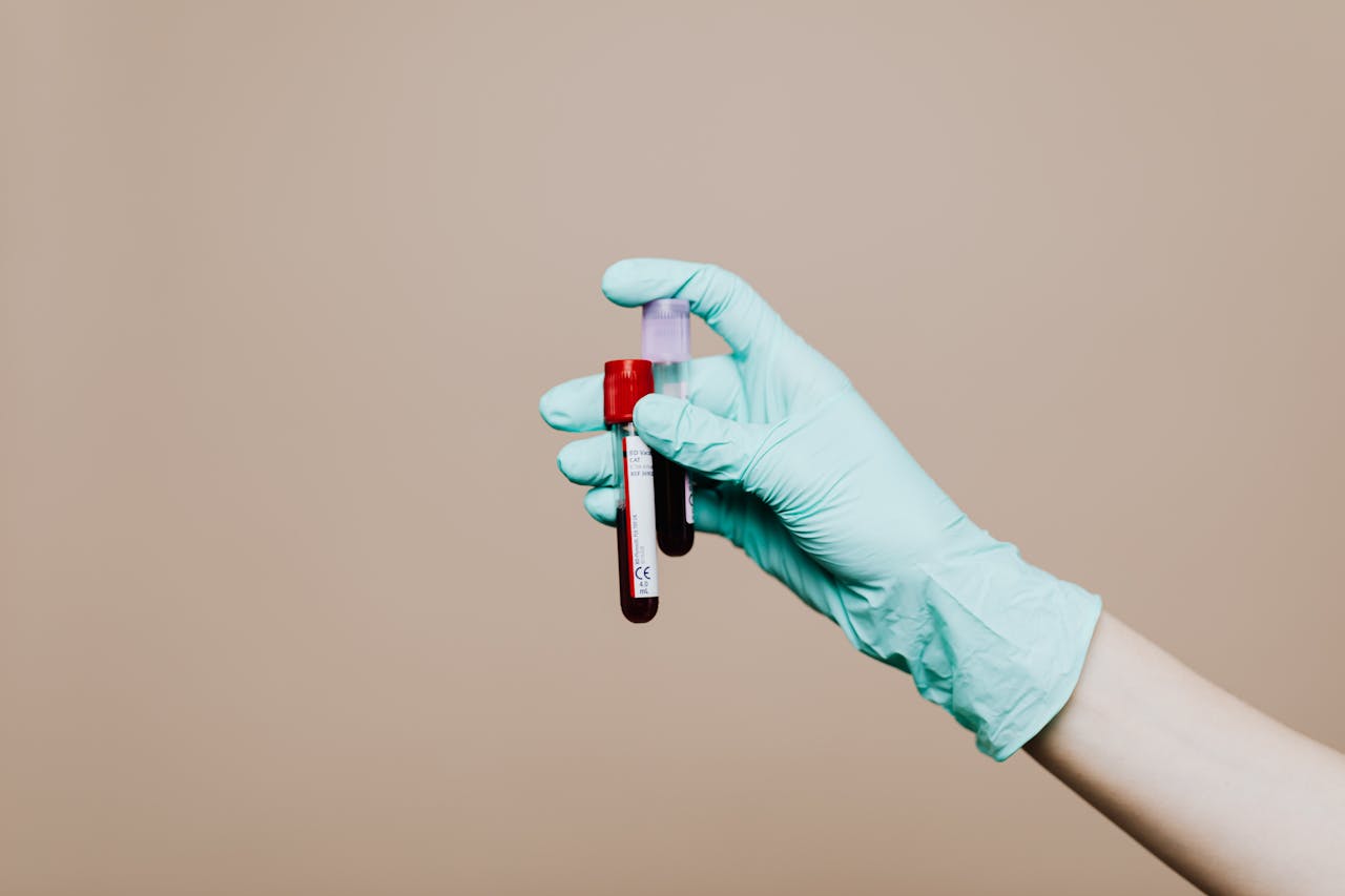 Health Decoder: How To Read Your Complete Blood Count Report