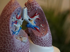 Lung Cancer No More Smokers' Disease: Experts Reveal How Everyone Is Affected, Even Children