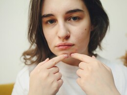 Shahnaz Hussain ने बताया सर्दियों में क्यों निकलते हैं पिंपल और बचने के 5 आसान नुस्खे