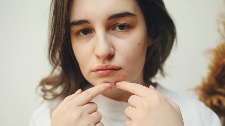 Shahnaz Hussain ने बताया सर्दियों में क्यों निकलते हैं पिंपल और बचने के 5 आसान नुस्खे