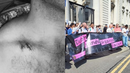 "They Were Kids, Probably 16-19 Years": Indian Man Attacked With Knife In Ireland