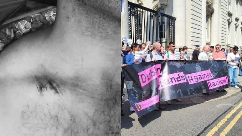 "They Were Kids, Probably 16-19 Years": Indian Man Attacked With Knife In Ireland