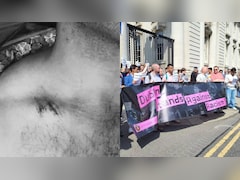 "3 Lads Surrounded Me, Then...": Indian Attacked In Ireland To NDTV